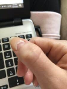 Fingernail splitting and falling off from cancer treatment with a laptop keyboard in the background